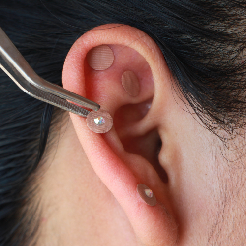 Pinzas para auriculoterapia